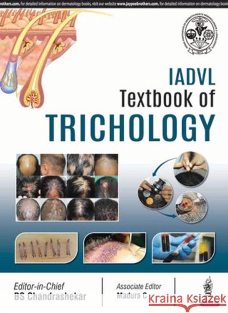 Iadvl Textbook of Trichology Bs Chandrashekar 9789352703913