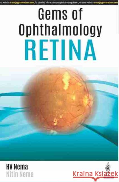 Gems of Ophthalmology: Retina Nema, Hv 9789352704026