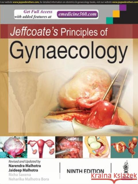 Jeffcoate's Principles of Gynaecology Narendra Malhotra 9789352704774