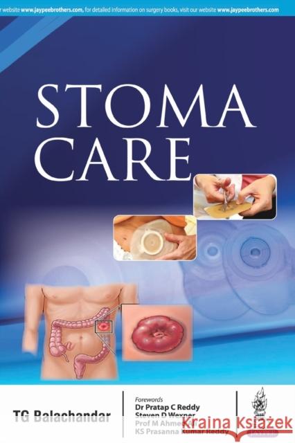 Stoma Care Tg Balachandar 9789352704873