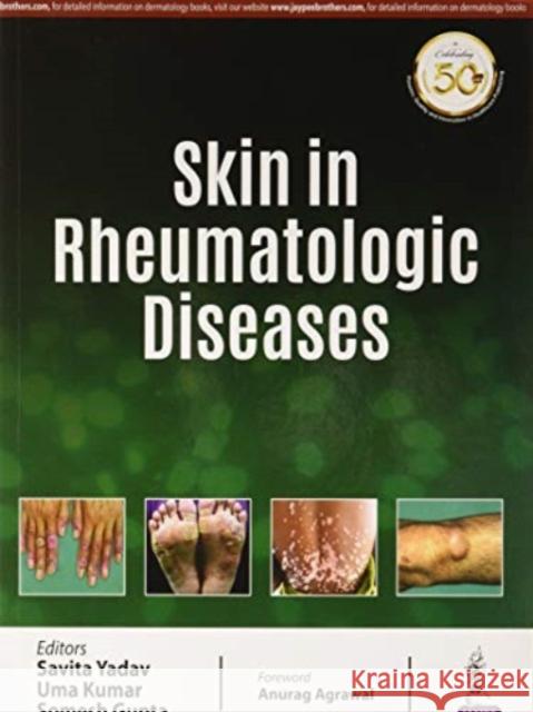 Skin in Rheumatologic Diseases Yadav Savita Uma Kumar Somesh Gupta 9789352705054 Jaypee Brothers Medical Publishers