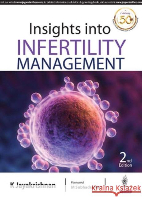 Insights Into Infertility Management K. Jayakrishnan 9789352705979