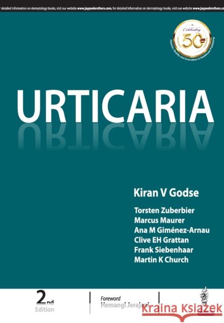 Urticaria Kiran V Godse   9789352706112