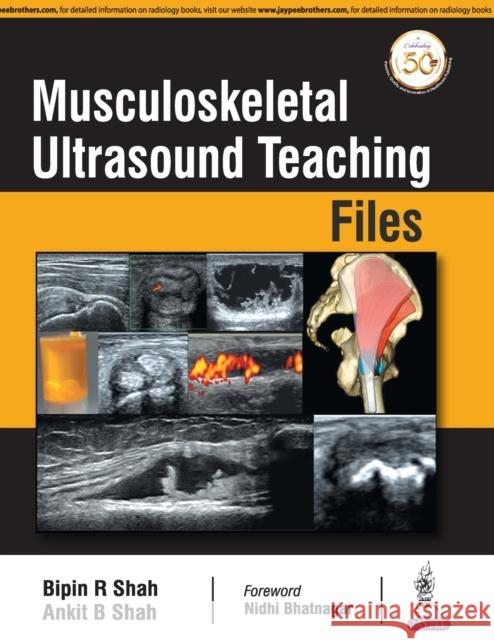 Musculoskeletal Ultrasound Teaching Files R. Bipin Shah 9789352706839 Jp Medical Ltd