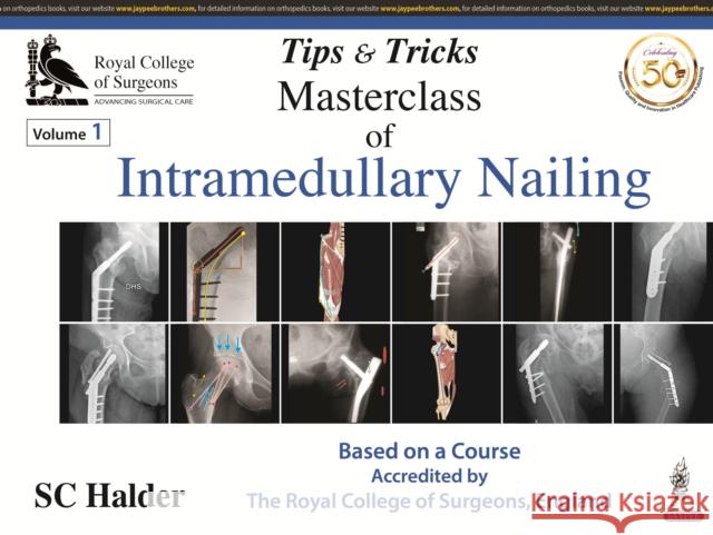 Tips and Tricks: Masterclass of Intramedullary Nailing C S Halder 9789352706990 JP Medical Publishers (RJ)