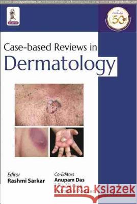 Case-based Reviews in Dermatology Rashmi Sarkar   9789352707058