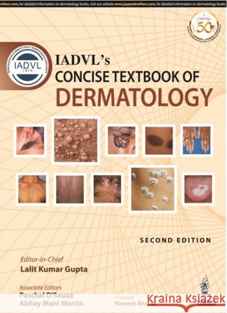 IADVL's Concise Textbook of Dermatology Lalit Kumar Gupta Paschal D'Souza Abhay Mani Martin 9789352707621