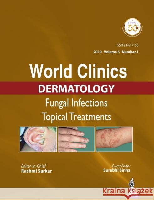 World Clinics in Dermatology: Fungal Infections: Topical Treatments Rashmi Sarkar Surabhi Sinha  9789352709984