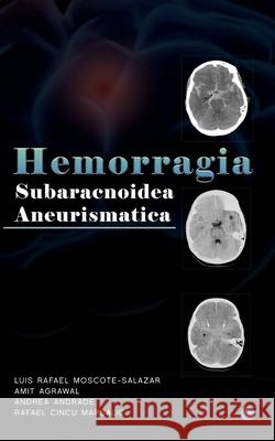 Hemorragia Subaracnoidea Aneurismatica Amit Agrawal 9789353478957 Bluerose Publishers Pvt. Ltd.