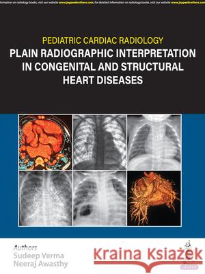 Pediatric Cardiac Radiology Neeraj Awasthy 9789354653520 Jaypee Brothers Medical Publishers