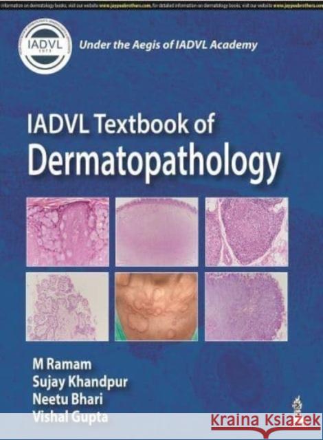 IADVL Textbook of Dermatopathology Vishal Gupta 9789354653841 Jaypee Brothers Medical Publishers