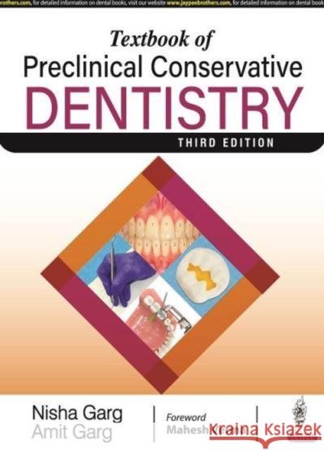 Textbook of Preclinical Conservative Dentistry Nisha Garg Amit Garg  9789354654855