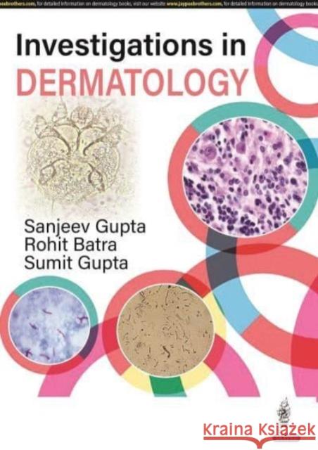 Investigations in Dermatology Sanjeev Gupta, Rohit Batra, Sumit Gupta 9789354655135 Jaypee Brothers Medical Publishers