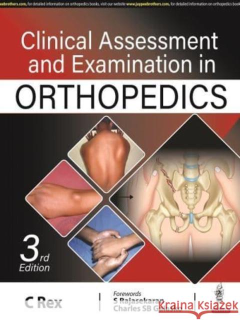 Clinical Assessment and Examination in Orthopedics C Rex   9789354655708 Jaypee Brothers Medical Publishers