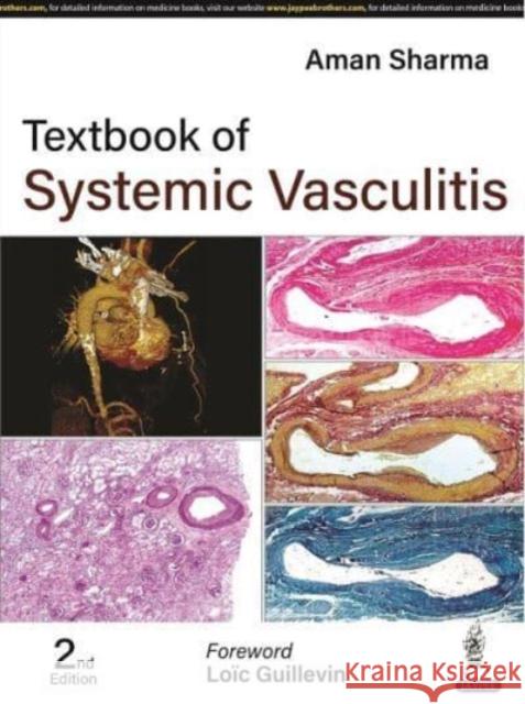 Textbook of Systemic Vasculitis Aman Sharma 9789354656583