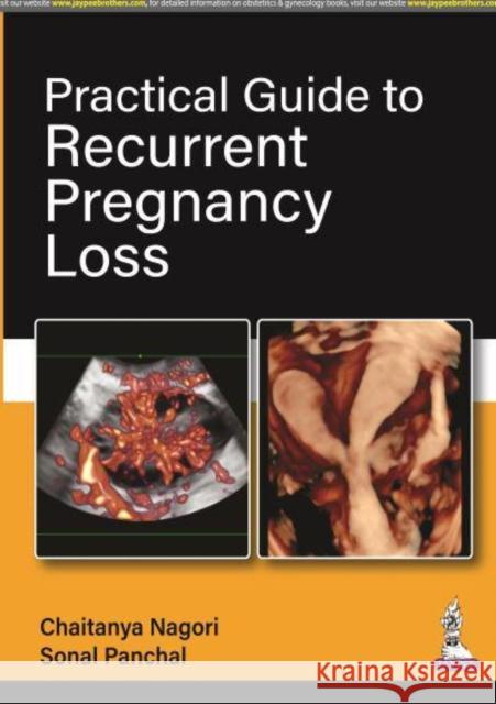 Practical Guide to Recurrent Pregnancy Loss Sonal Panchal 9789354656644 Jaypee Brothers Medical Publishers