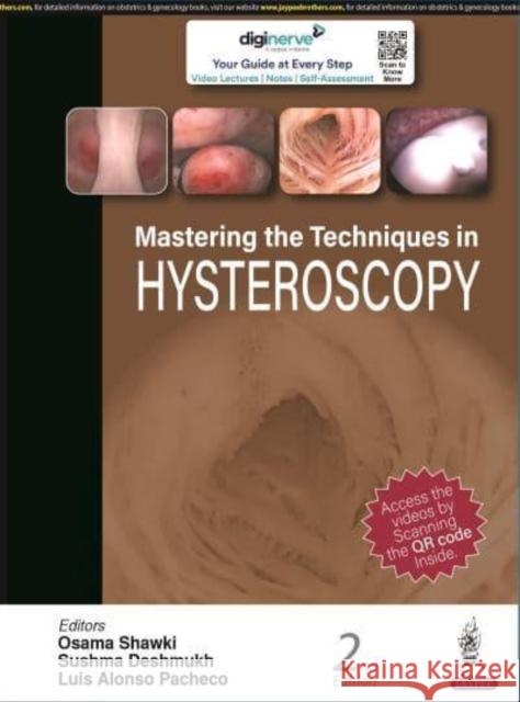 Mastering the Techniques in Hysteroscopy Osama Shawki Sushma Deshmukh Luis Alonso Pacheco 9789354657559