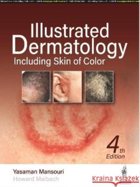 Illustrated Dermatology: Including Skin of Colour Yasaman Mansouri Howard Maibach  9789354657573 Jaypee Brothers Medical Publishers