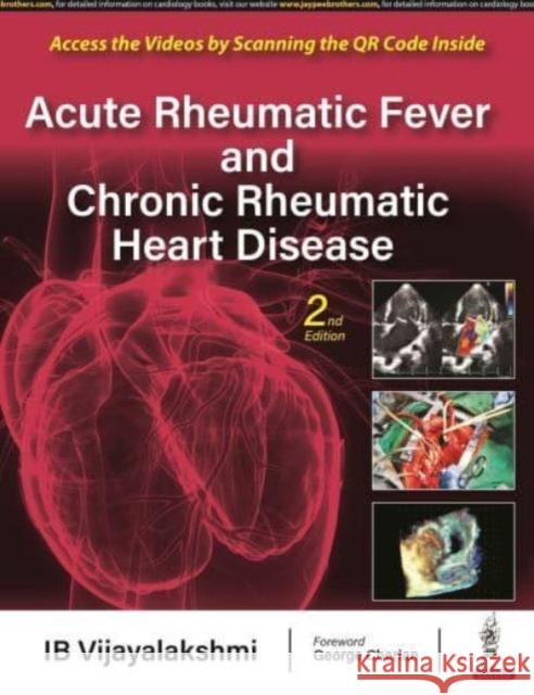 Acute Rheumatic Fever and Chronic Rheumatic Heart Disease IB Vijayalakshmi 9789354658785 Jaypee Brothers Medical Publishers
