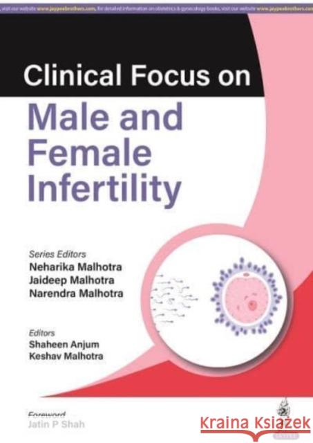 Clinical Focus on Male & Female Infertility Neharika Malhotra Jaideep Malhotra Narendra Malhotra 9789356960954 Jaypee Brothers Medical Publishers