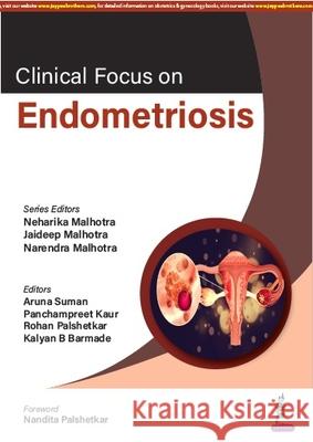 Clinical Focus on Endometriosis Narendra Malhotra 9789356961265