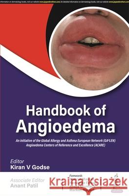 Handbook of Angioedema Anant Patil 9789356961647