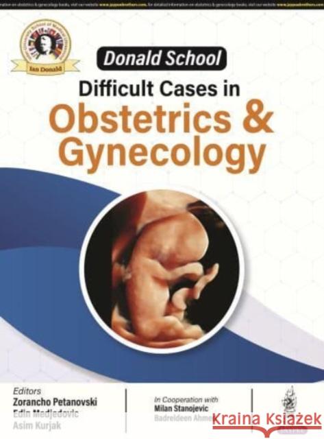 Donald School: Difficult Cases in Obstetrics and Gynecology Asim Kurjak 9789356962606