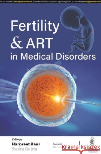 Fertility & ART in Medical Disorders Sweta Gupta 9789356963122