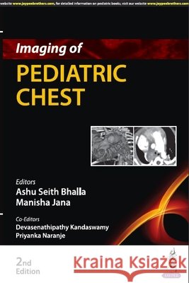 Imaging of Pediatric Chest Ashu Seith Bhalla, Manisha Jana, Devasenathipathy Kandaswamy 9789356964341