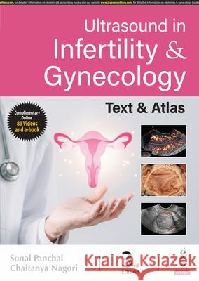 Ultrasound in Infertility & Gynecology Chaitanya Nagori 9789356964921