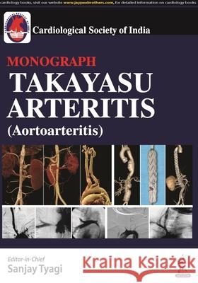 Takayasu Arteritis (Aortoarteritis) George Joseph 9789356965669 Jaypee Brothers Medical Publishers