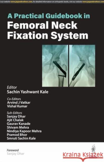 A Practical Guidebook in Femoral Neck Fixation System Vishal Kumar 9789356965959