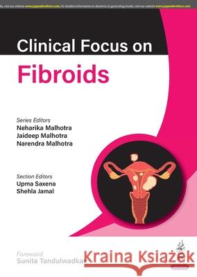 Clinical Focus on Fibroids Neharika Malhotra, Jaideep Malhotra, Narendra Malhotra 9789356966314