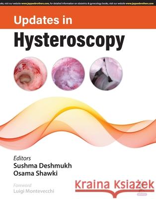 Updates in Hysteroscopy Osama Shawki 9789356967458