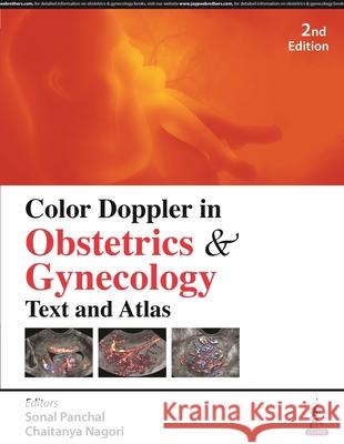 Color Doppler in Obstetrics & Gynecology Chaitanya Nagori 9789356969605