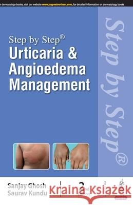 Step by Step: Urticaria & Angioedema Management Sanjay Ghosh, Saurav Kundu 9789356969827