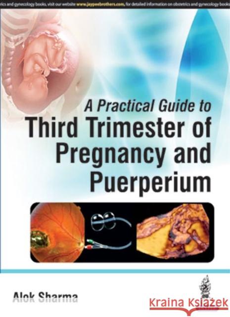 A Practical Guide to Third Trimester of Pregnancy & Puerperium Alok Sharma 9789385891298 Jaypee Brothers, Medical Publishers Pvt. Ltd.