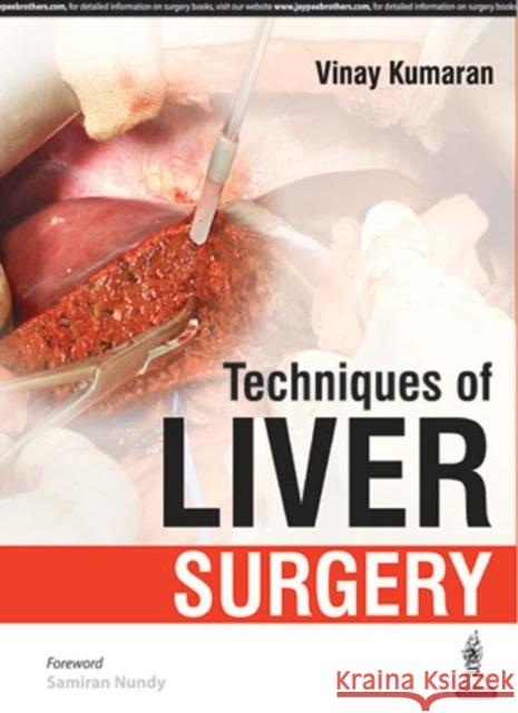 Techniques of Liver Surgery Vinay Kumaran 9789385891564 Jaypee Brothers, Medical Publishers Pvt. Ltd.