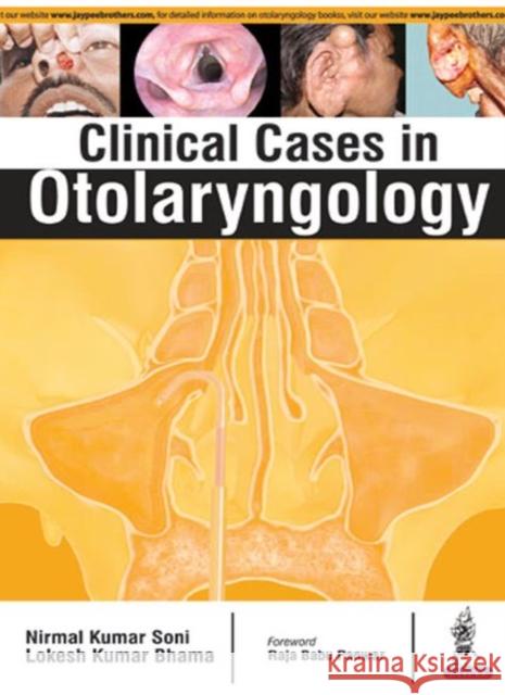 Clinical Cases in Otolaryngology Kumar Nirmal Soni 9789385891618