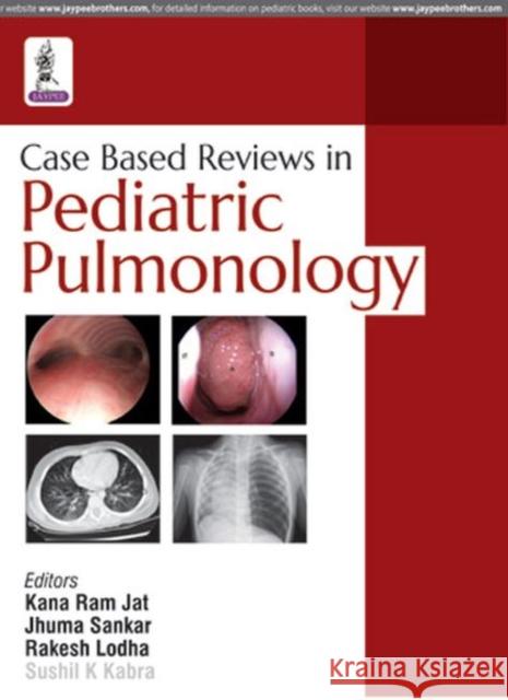 Case Based Reviews in Pediatric Pulmonology Sushil K. Kabra 9789385891861 Jaypee Brothers, Medical Publishers Pvt. Ltd.