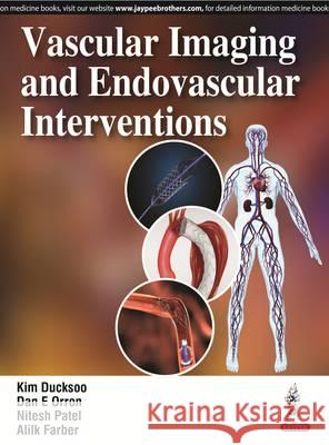 Vascular Imaging and Intervention Kim, Ducksoo 9789385999024 Jaypee Brothers, Medical Publishers Pvt. Ltd.