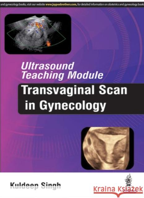 Ultrasound Teaching Module: Transvaginal Scan in Gynecology Kuldeep Singh 9789385999260