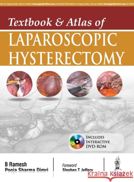 Textbook and Atlas of Laparoscopic Hysterectomy B, Ramesh Sharma 9789385999284