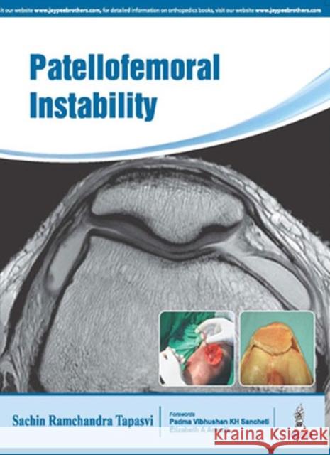 Patellofemoral Instability: Knee Joint Sachin Tapasvi 9789385999666