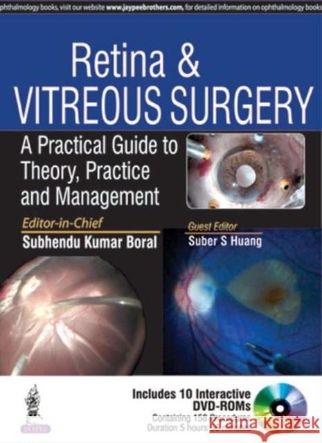 Retina & Vitreous Surgery: A Practical Guide to Theory, Practice and Management Subhendu Kumar Boral 9789385999703 Jaypee Brothers, Medical Publishers Pvt. Ltd.