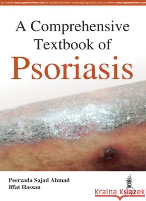 A Comprehensive Textbook of Psoriasis Ahmad, Peerzada Sajad 9789385999826 Jaypee Brothers, Medical Publishers Pvt. Ltd.