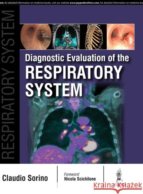 Diagnostic Evaluation of the Respiratory System Claudio Sorino 9789386056009 Jaypee Brothers, Medical Publishers Pvt. Ltd.