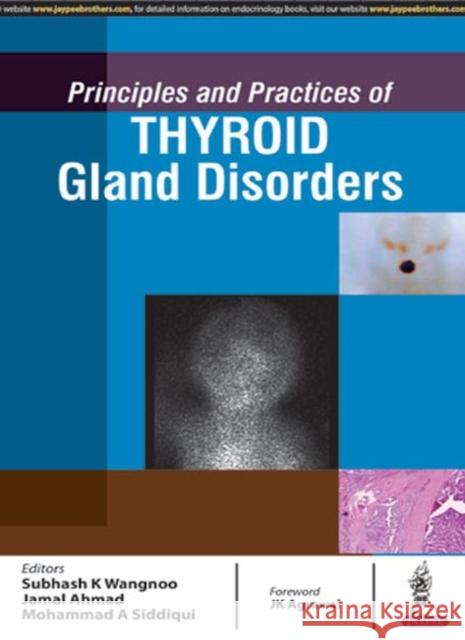 Principles and Practices of Thyroid Gland Disorders Wangnoo, Subhash Kumar 9789386056252