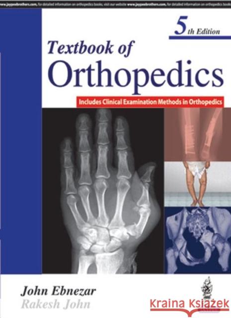 Textbook of Orthopedics John Ebnezar 9789386056689 Jaypee Brothers, Medical Publishers Pvt. Ltd.