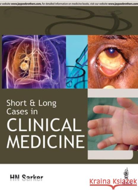 Short and Long Cases in Clinical Medicine Nath Harendra Sarker 9789386056894